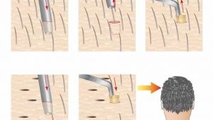 Fue tekniği hakkında çeşitli bilgiler